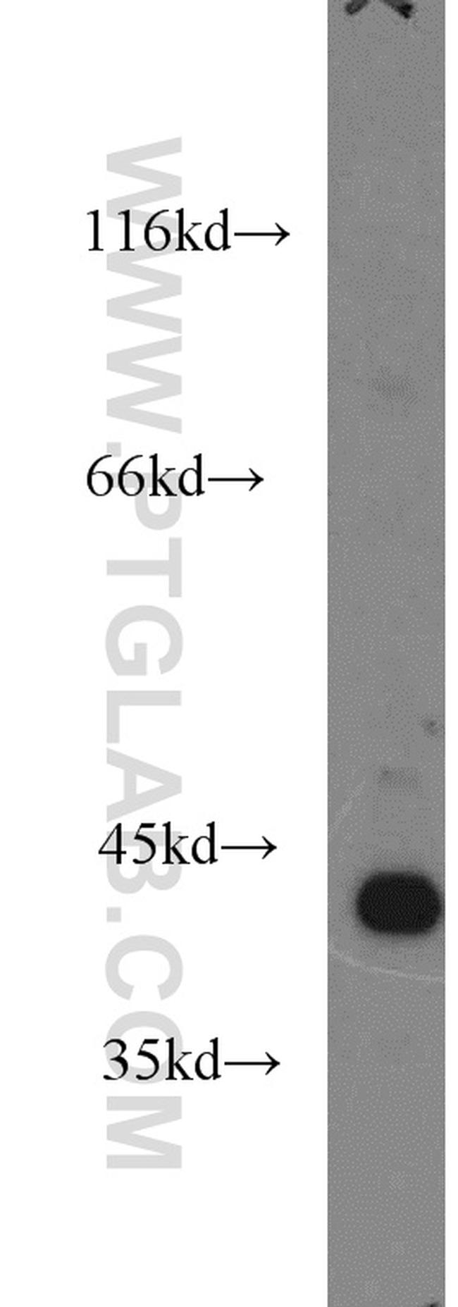 ARG2 Antibody in Western Blot (WB)