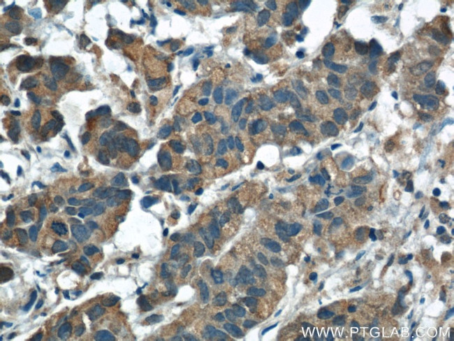 ARG2 Antibody in Immunohistochemistry (Paraffin) (IHC (P))