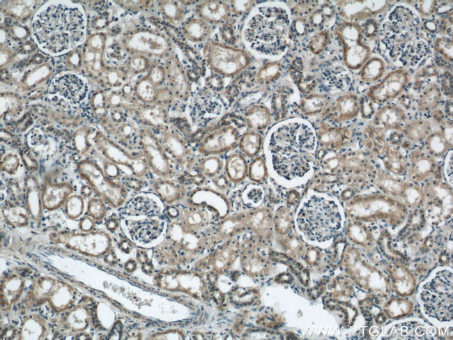 ARG2 Antibody in Immunohistochemistry (Paraffin) (IHC (P))