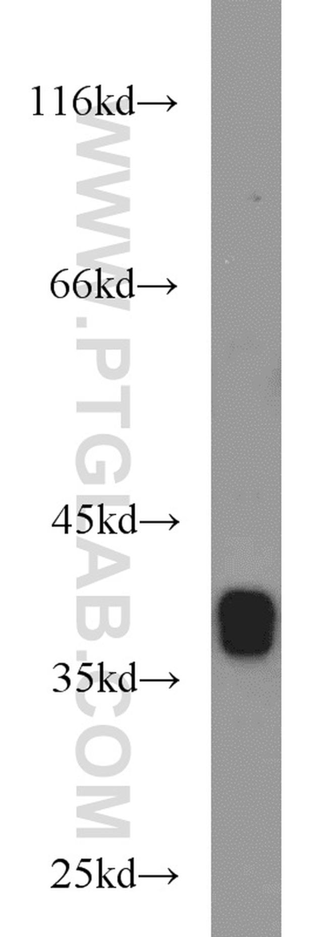 ARG2 Antibody in Western Blot (WB)