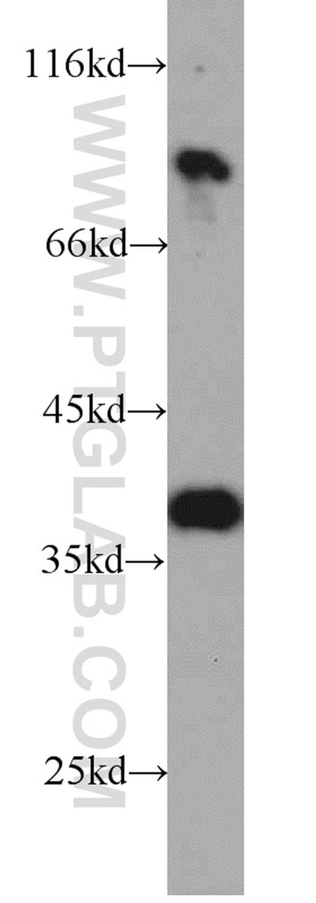 ARG2 Antibody in Western Blot (WB)