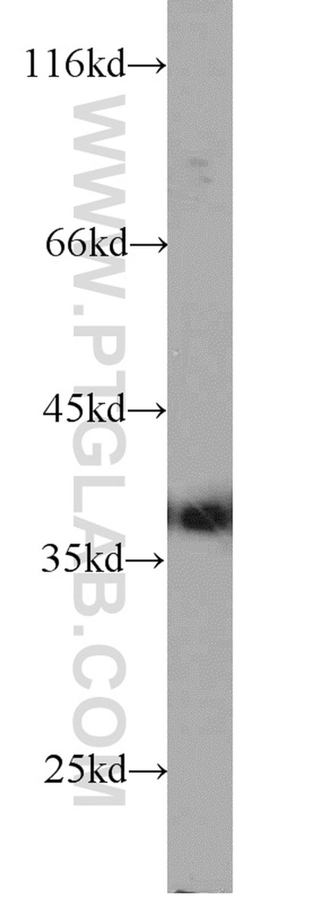 ARG2 Antibody in Western Blot (WB)