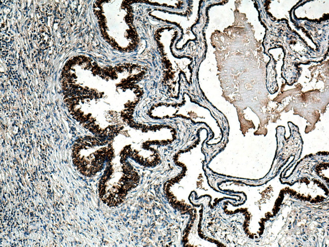 ARG2 Antibody in Immunohistochemistry (Paraffin) (IHC (P))