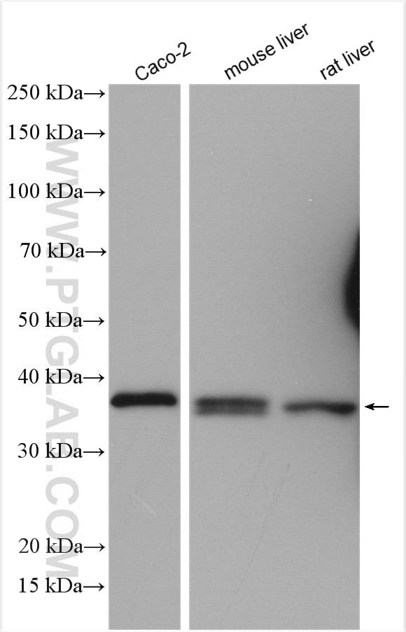 ARG2 Antibody in Western Blot (WB)