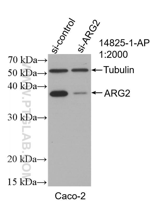 ARG2 Antibody in Western Blot (WB)