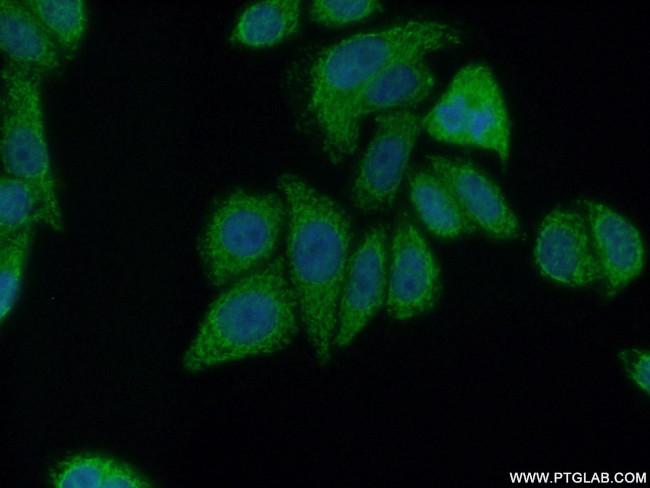 PCYT2 Antibody in Immunocytochemistry (ICC/IF)