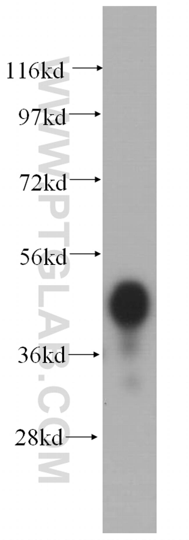 PCYT2 Antibody in Western Blot (WB)