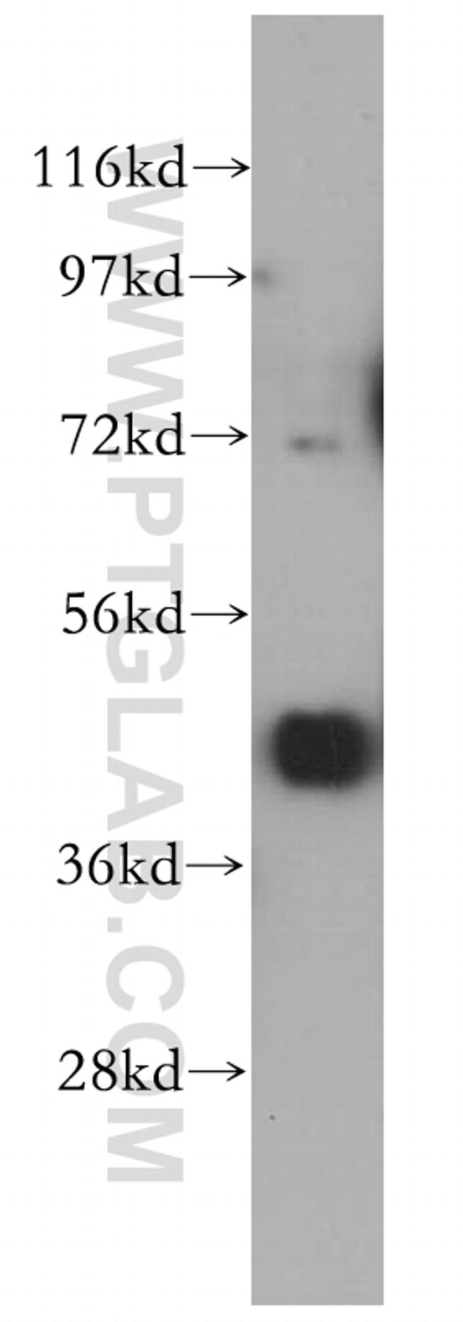PCYT2 Antibody in Western Blot (WB)