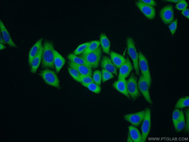 MARS Antibody in Immunocytochemistry (ICC/IF)