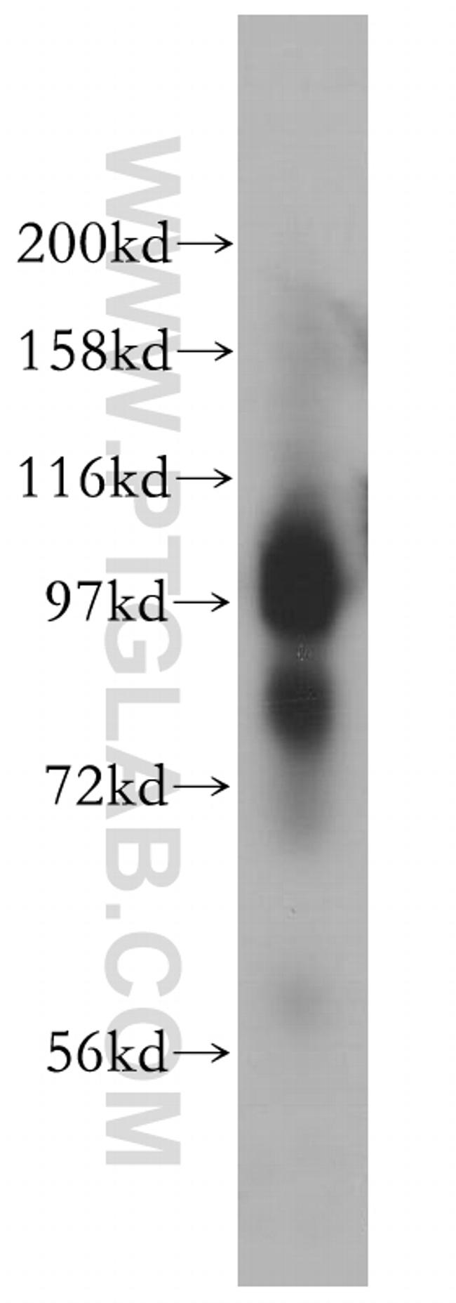 MARS Antibody in Western Blot (WB)