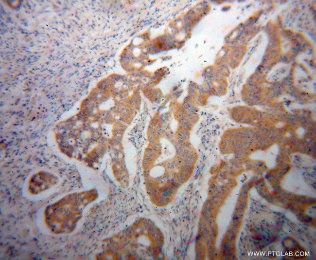 UMPS Antibody in Immunohistochemistry (Paraffin) (IHC (P))