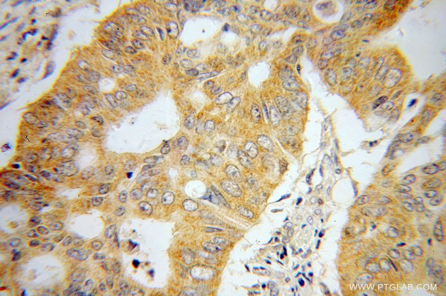 UMPS Antibody in Immunohistochemistry (Paraffin) (IHC (P))