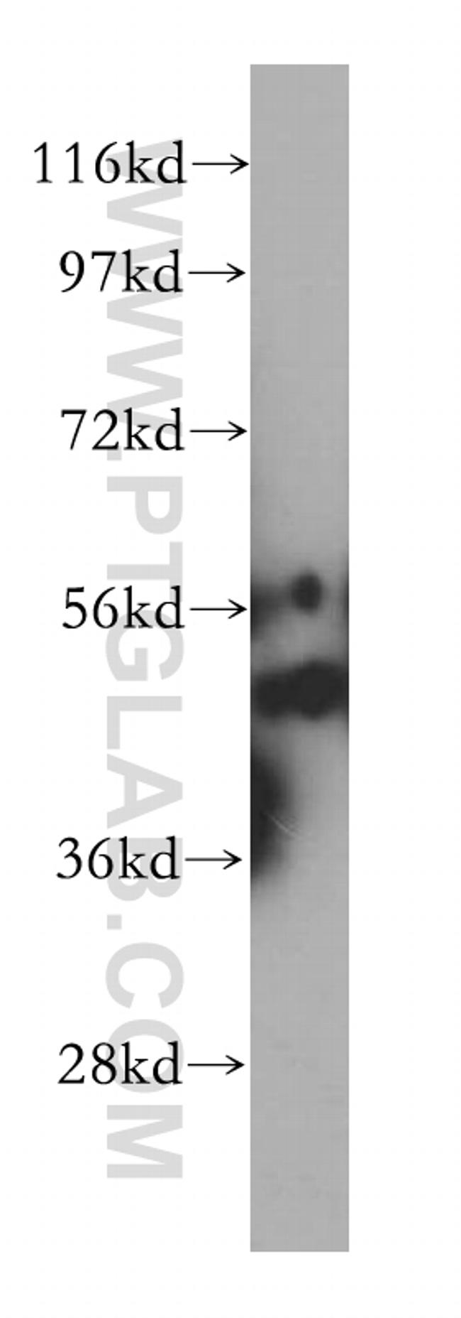 UMPS Antibody in Western Blot (WB)