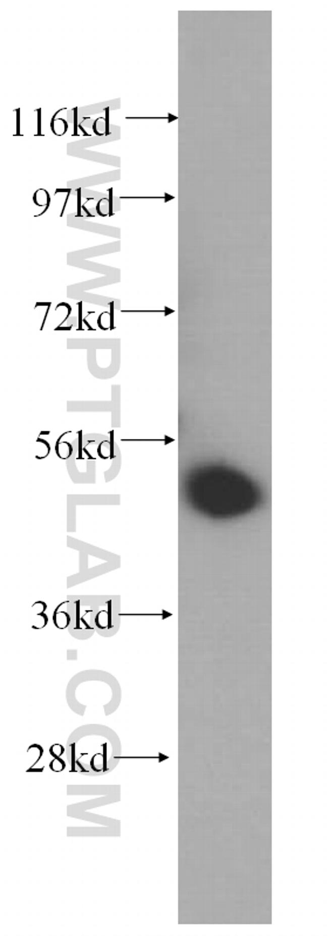 UMPS Antibody in Western Blot (WB)