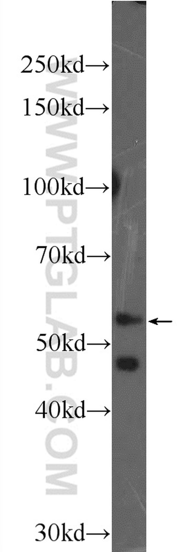 UMPS Antibody in Western Blot (WB)