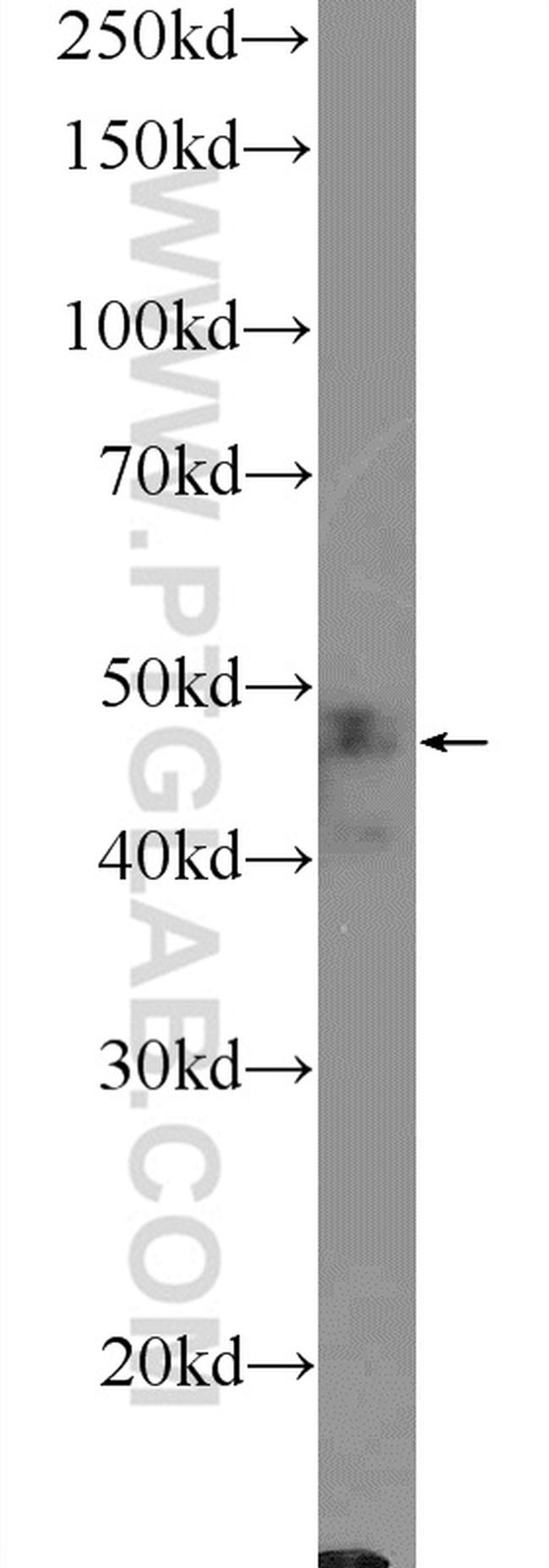 UMPS Antibody in Western Blot (WB)