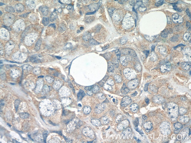 ATF2 Antibody in Immunohistochemistry (Paraffin) (IHC (P))