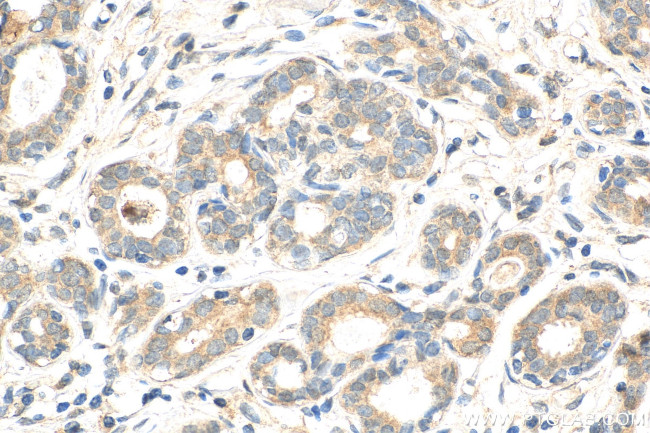 ATF2 Antibody in Immunohistochemistry (Paraffin) (IHC (P))