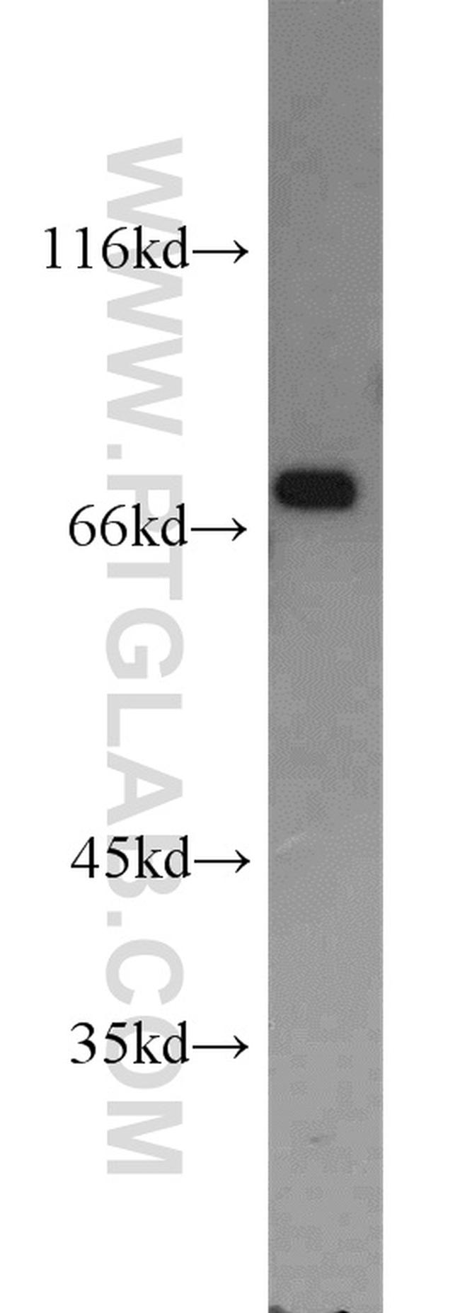 ATF2 Antibody in Western Blot (WB)