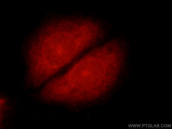 UBC9 Antibody in Immunocytochemistry (ICC/IF)