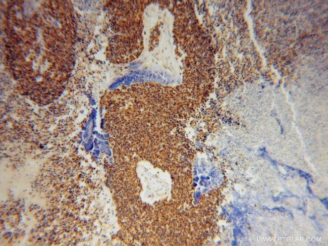 UBC9 Antibody in Immunohistochemistry (Paraffin) (IHC (P))