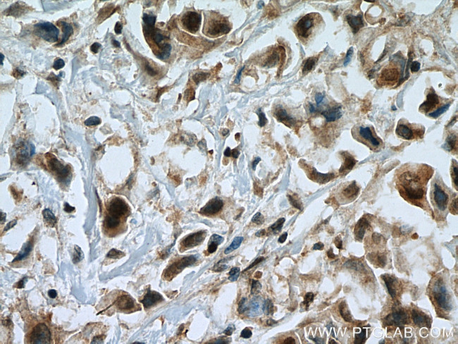 UBC9 Antibody in Immunohistochemistry (Paraffin) (IHC (P))