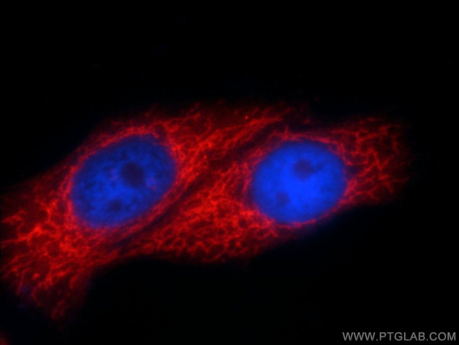 SLC25A6 Antibody in Immunocytochemistry (ICC/IF)