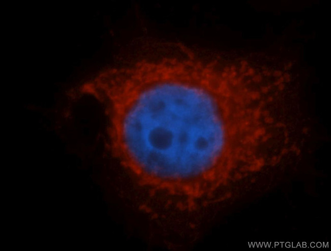 SLC25A6 Antibody in Immunocytochemistry (ICC/IF)