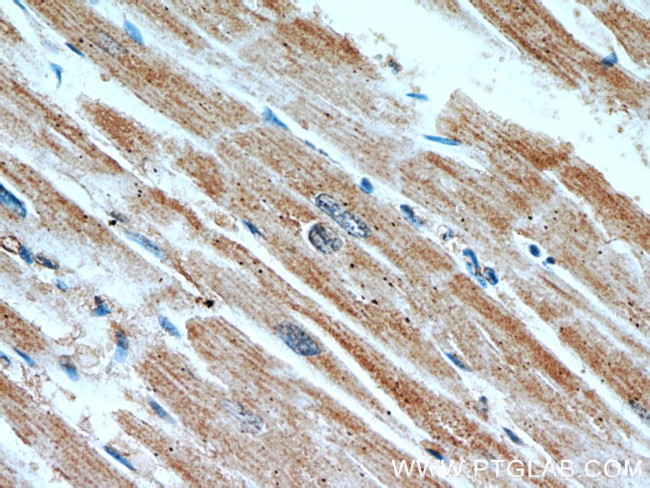 SLC25A6 Antibody in Immunohistochemistry (Paraffin) (IHC (P))