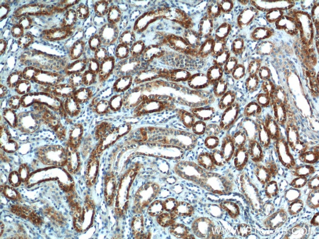 SLC25A6 Antibody in Immunohistochemistry (Paraffin) (IHC (P))