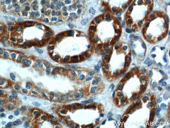 SLC25A6 Antibody in Immunohistochemistry (Paraffin) (IHC (P))