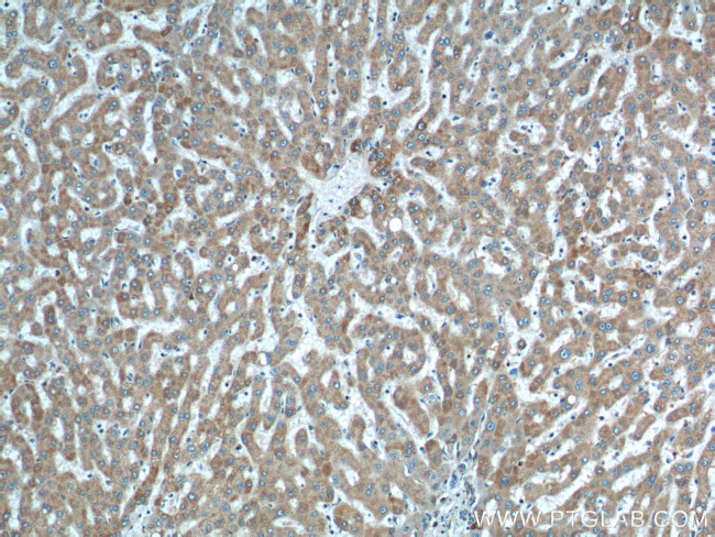 SLC25A6 Antibody in Immunohistochemistry (Paraffin) (IHC (P))