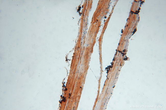 SLC25A6 Antibody in Immunohistochemistry (Paraffin) (IHC (P))