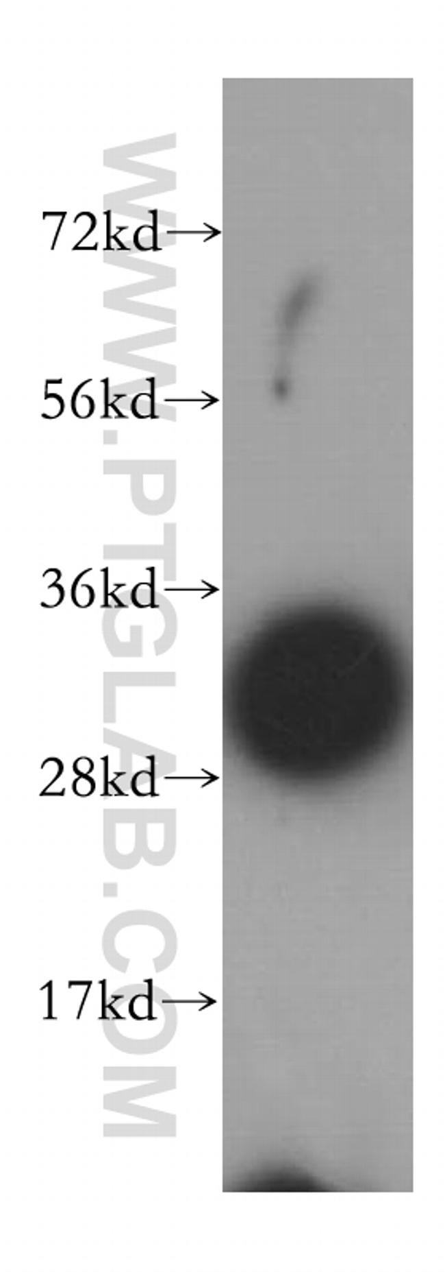 SLC25A6 Antibody in Western Blot (WB)