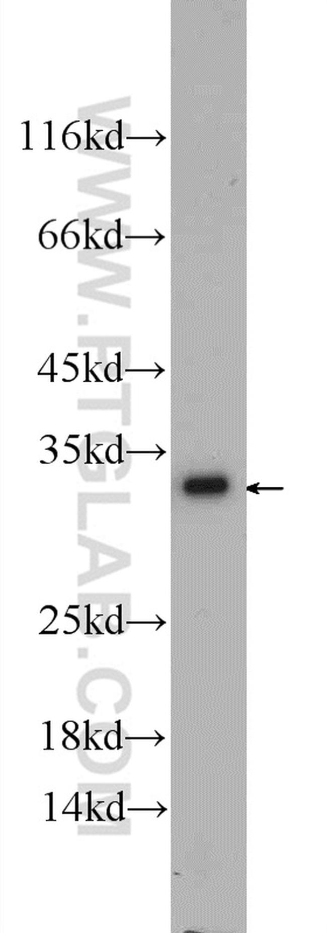 SLC25A6 Antibody in Western Blot (WB)