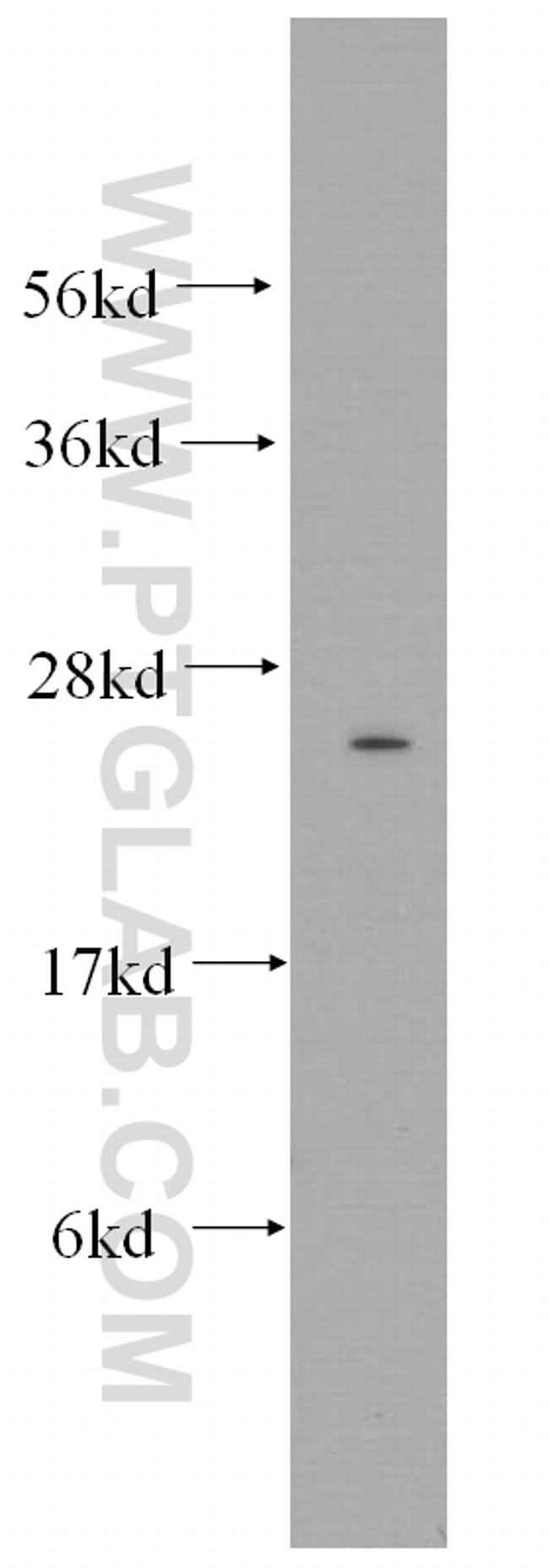 Connexin-26 Antibody in Western Blot (WB)