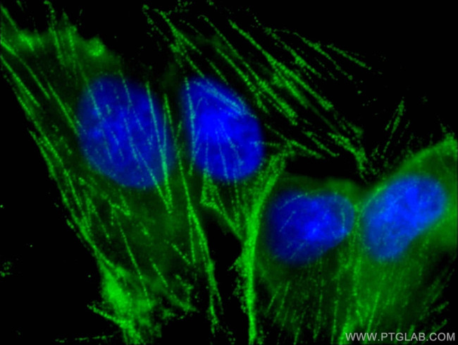 Myh9 Antibody in Immunocytochemistry (ICC/IF)