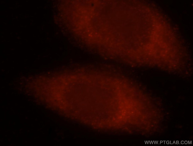 Myh9 Antibody in Immunocytochemistry (ICC/IF)