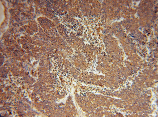 Myh9 Antibody in Immunohistochemistry (Paraffin) (IHC (P))