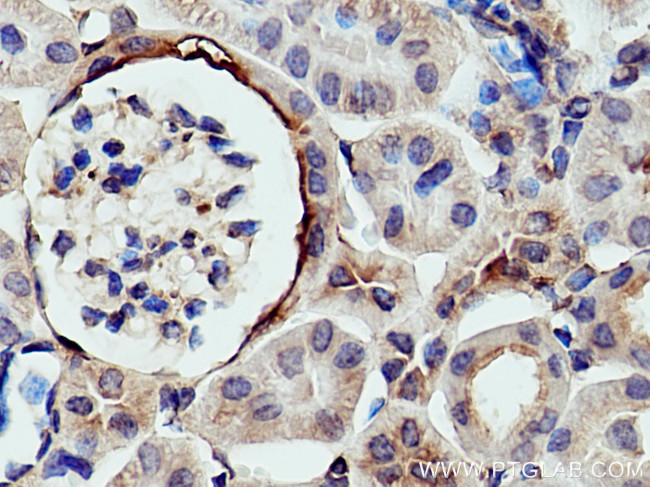 Myh9 Antibody in Immunohistochemistry (Paraffin) (IHC (P))