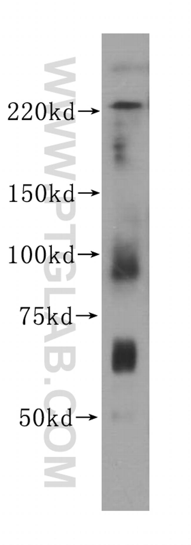 Myh9 Antibody in Western Blot (WB)