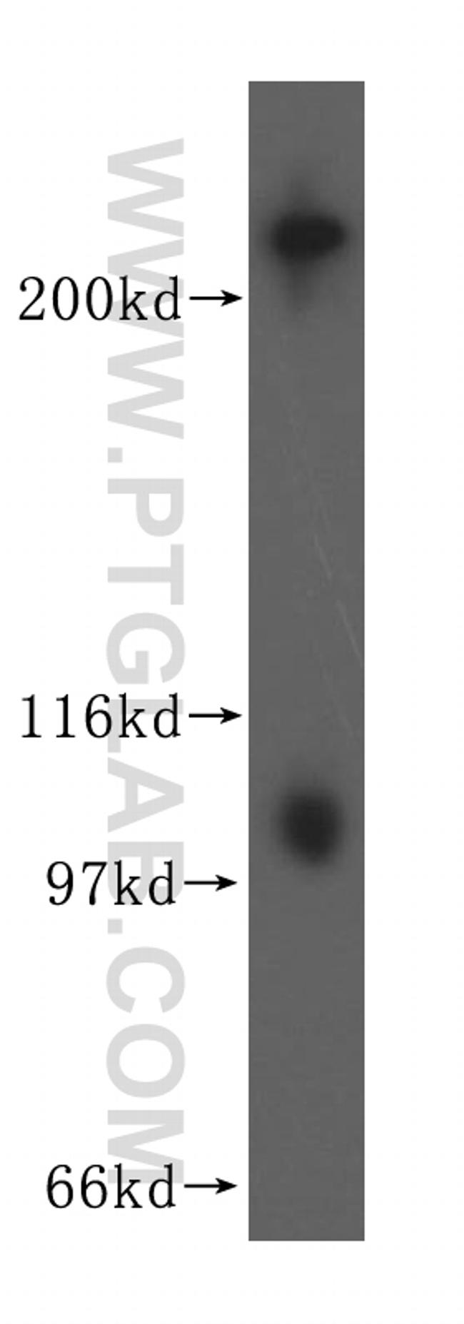 Myh9 Antibody in Western Blot (WB)