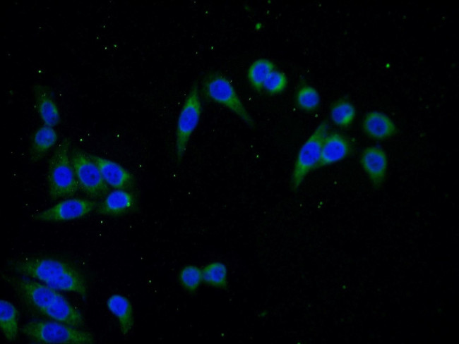 SEC61B Antibody in Immunocytochemistry (ICC/IF)