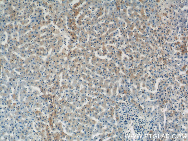 SEC61B Antibody in Immunohistochemistry (Paraffin) (IHC (P))