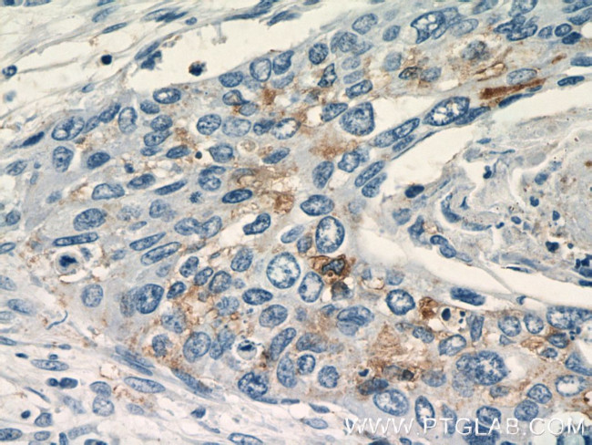 SEC61B Antibody in Immunohistochemistry (Paraffin) (IHC (P))