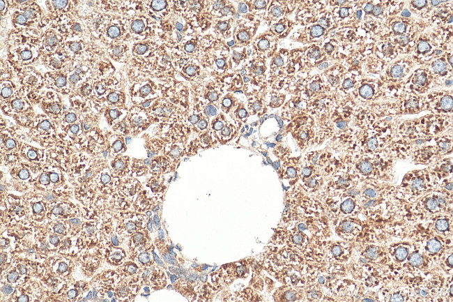 SEC61B Antibody in Immunohistochemistry (Paraffin) (IHC (P))