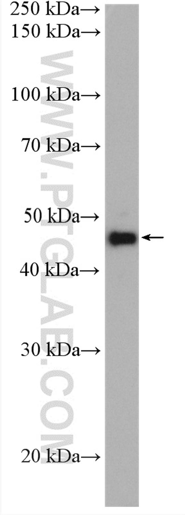 Phospho-Gsk3b (Ser389) Antibody in Western Blot (WB)