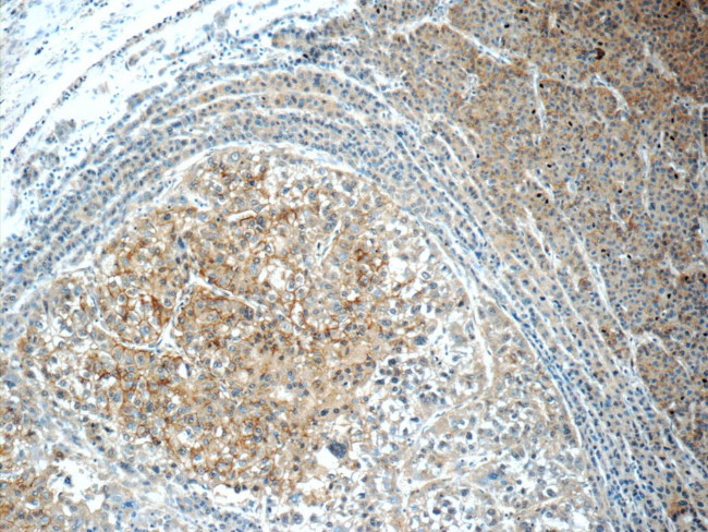 CUL4A Antibody in Immunohistochemistry (Paraffin) (IHC (P))