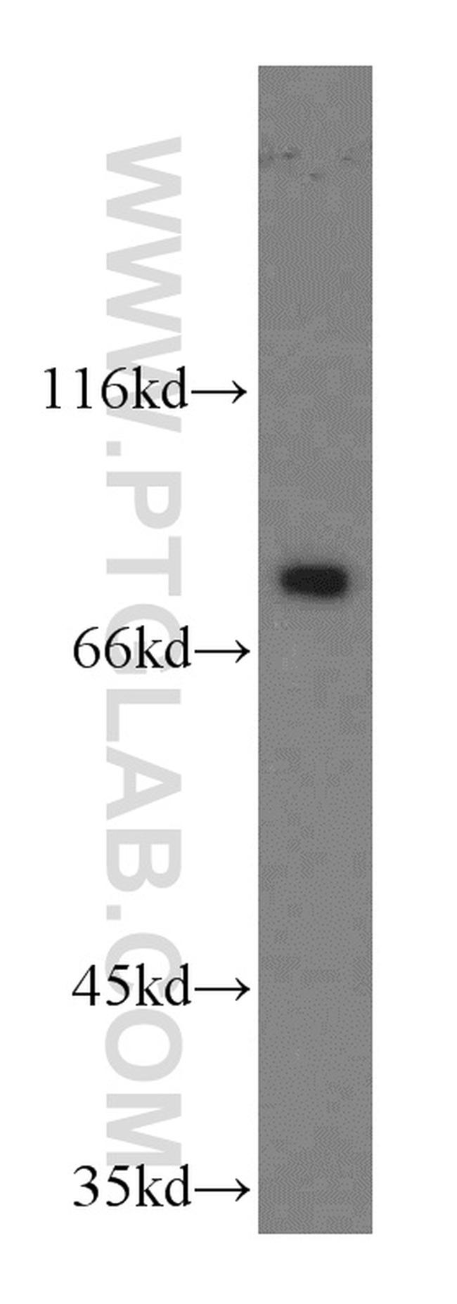 CUL4A Antibody in Western Blot (WB)