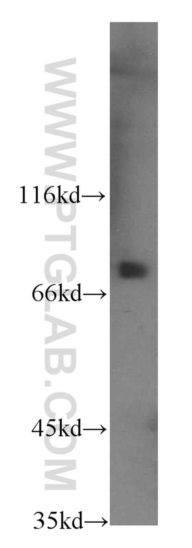 CUL4A Antibody in Western Blot (WB)